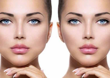 Ultrassom 3D com ajuste de profundidade faz bichectomia sem bisturi