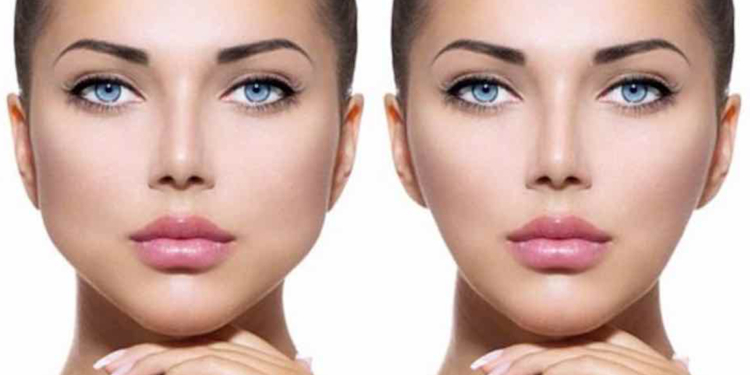 Ultrassom 3D com ajuste de profundidade faz bichectomia sem bisturi