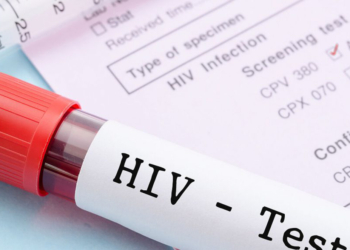 Tratamento inédito brasileiro anuncia que paciente está há 17 meses sem vírus HIV