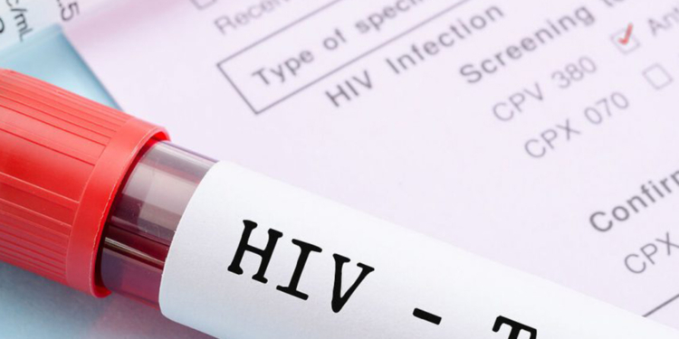 Tratamento inédito brasileiro anuncia que paciente está há 17 meses sem vírus HIV