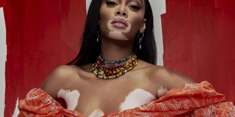 Winnie Harlow estrela Color Feelings, coleção de verão da Colcci