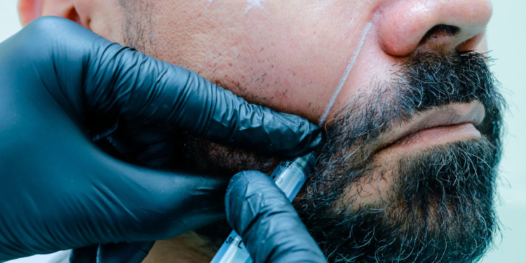 Como proceder com a harmonização facial que deu errado?