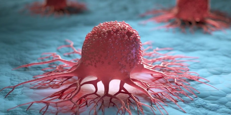 Dostarlimab: remédio capaz de eliminar 100% o câncer é aprovado pela Anvisa